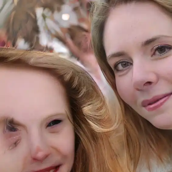 An image of two people. The person on the right is lifelike. The person on the left starts off lifelike but the nose is deformed and the eye transforms into paint-like smudges.